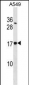 SSR4 Antibody (Center)